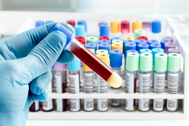 "Privatne laboratorije neka rade PCR testove, ako imaju kapacitete"